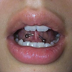 Frenulum-piercing